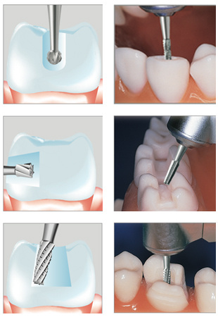 Anwendung Stahlinstrumente Anwendung Stahlinstrumente